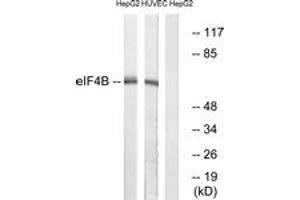 Western blot analysis of extracts from HepG2/HuvEc cells, using eIF4B (Ab-422) Antibody. (EIF4B anticorps  (AA 388-437))