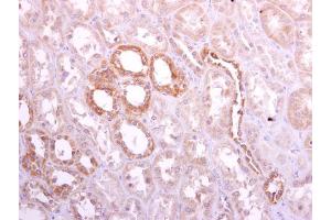 IHC-P Image Ribophorin I antibody [C2C3], C-term detects Ribophorin I protein at cytoplasm on human normal kidney by immunohistochemical analysis. (RPN1 anticorps  (C-Term))