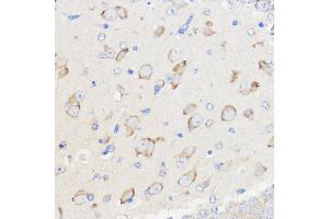 Immunohistochemistry of paraffin-embedded Mouse brain using WBSCR27 Rabbit pAb (ABIN7271366) at dilution of 1:50 (40x lens).