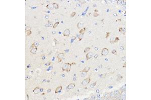 Immunohistochemistry of paraffin-embedded Mouse brain using WBSCR27 Rabbit pAb (ABIN7271366) at dilution of 1:50 (40x lens). (WBSCR27 anticorps  (AA 1-245))