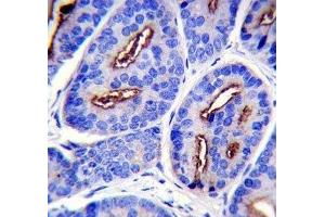 PSMA antibody immunohistochemistry analysis in formalin fixed and paraffin embedded human prostate carcinoma.