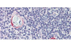Rabbit Anti-CPXCR1 Antibody Catalog Number: arp39743 Paraffin Embedded Tissue: Human Tymus Antibody Concentration: 10 ug/ml (CPXCR1 anticorps  (Middle Region))
