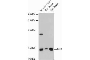 Western blot analysis of extracts of various cell lines, using BNP antibody (ABIN3023135, ABIN3023136, ABIN3023137, ABIN1513273 and ABIN6219406) at 1:1000 dilution.