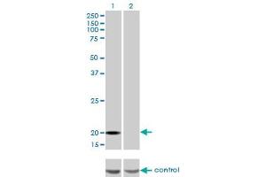 Western blot analysis of FTL over-expressed 293 cell line, cotransfected with FTL Validated Chimera RNAi (Lane 2) or non-transfected control (Lane 1).