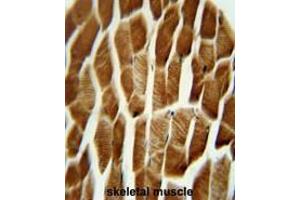 CAP1S3 antibody (N-term) immunohistochemistry analysis in formalin fixed and paraffin embedded human skeletal muscle followed by peroxidase conjugation of the secondary antibody and DAB staining.