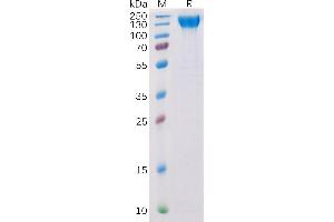 Human VE Protein, His Tag on SDS-PAGE under reducing condition.