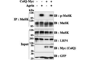 Rat ColQ-/- muscle cells were transduced to express ColQ-Myc (+) or not (-).