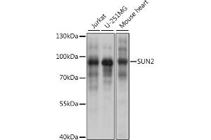 Western blot analysis of extracts of various cell lines, using SUN2 antibody (ABIN7270136) at 1:1000 dilution. (SUN2 anticorps)