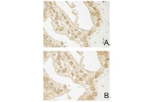 Immunohistochemistry of Mouse Anti-AKT3 antibody. (AKT3 anticorps  (Internal Region) (Biotin))