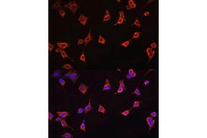 Immunofluorescence analysis of NIH/3T3 cells using CFL1 antibody. (Cofilin anticorps  (AA 1-100))