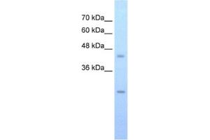 anti-FLJ20489 antibody