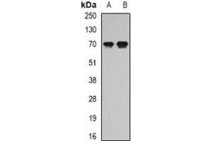 Western blot analysis of Secretogranin-2 expression in SW620 (A), Jurkat (B) whole cell lysates. (SCG2 anticorps)