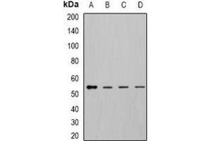 Western blot analysis of DLD expression in MCF7 (A), K562 (B), mouse kidney (C), mouse liver (D) whole cell lysates.