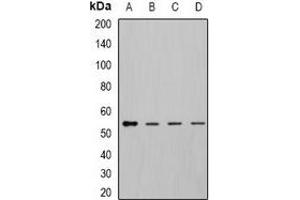 Western blot analysis of DLD expression in MCF7 (A), K562 (B), mouse kidney (C), mouse liver (D) whole cell lysates. (DLD anticorps)