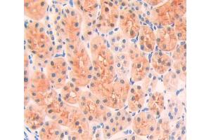Used in DAB staining on fromalin fixed paraffin- embedded kidney tissue
