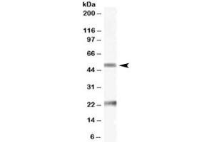 Western blot testing of human ovay lysate with Fibulin 5 antibody at 0. (Fibulin 5 anticorps)