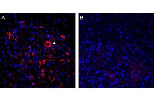 Expression of ASIC2a in rat spinal cord.