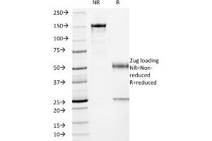 SDS-PAGE Analysis Purified p53 Mouse Monoclonal Antibody (TP53/2719). (p53 anticorps)