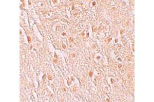 Immunohistochemical staining of human brain cells with PION polyclonal antibody  at 5 ug/mL. (GSAP anticorps  (C-Term))