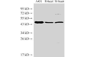 Western Blot analysis of 1)A431, 2)Rat heart, 3)Mouse heart using SERPINB2 Polyclonal Antibody at dilution of 1:1000 (SERPINB2 anticorps)