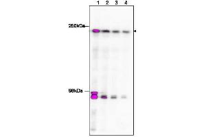 Western blot using  affinity purified anti-TAF1 to detect TAF1 in HeLa nuclear extract (arrowhead).