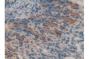 Detection of CAT in Mouse Stomach Tissue using Polyclonal Antibody to Catalase (CAT)