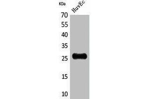 Western Blot analysis of HuvEc cells using CacyBP Polyclonal Antibody. (CACYBP anticorps  (C-Term))