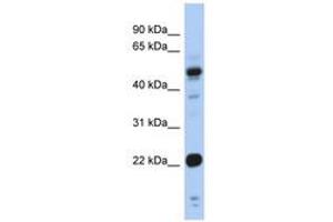 Image no. 1 for anti-Cysteine and Glycine-Rich Protein 1 (CSRP1) (AA 71-120) antibody (ABIN6742467) (CSRP1 anticorps  (AA 71-120))