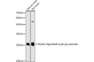 Western blot analysis of extracts of various cell lines, using Myelin oligodendrocyte glycoprotein antibody (ABIN6128312, ABIN6143943, ABIN6143944 and ABIN6220990) at 1:1000 dilution.
