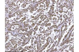 IHC analysis of JHDM3A/JMJD2A/KDM4A using anti-JHDM3A/JMJD2A/KDM4A antibody (ABIN7601534). (KDM4A anticorps  (AA 379-1064))