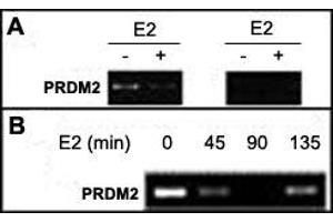 A : Soluble chromatin was prepared from MCF-7 cells not treated or treated with E2 for 45 min. (PRDM2 anticorps  (AA 1-347))