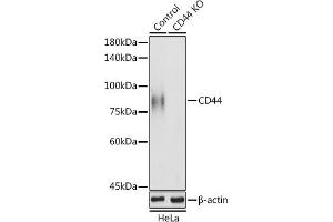 Western blot analysis of extracts of HeLa cells, using CD44 antibody (ABIN6127602, ABIN6138193, ABIN6138195 and ABIN7101398) at 1:1000 dilution. (CD44 anticorps  (AA 148-247))