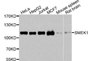 Western blot analysis of extracts of various cell lines, using SMEK1 antibody. (SMEK1 anticorps)