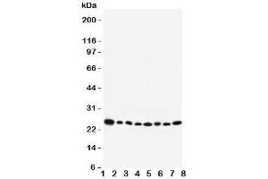 Western blot testing of Rab8 antibody and Lane 1:  rat brain;  2: mouse brain;  3: human placenta;  4: (h) HeLa;  5: (r) PC12;  6: (m) NIH3T3;  7: (h) A431;  8: (h) 293T lysate.