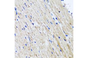 Immunohistochemistry of paraffin-embedded mouse heart using HY antibody  at dilution of 1:100 (40x lens). (HYAL1 anticorps  (AA 136-435))