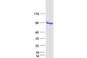 Validation with Western Blot