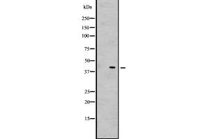 Western blot analysis of GNRHR2 expression in Hela cell lysate,The lane on the left is treated with the antigen-specific peptide.