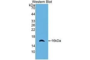 Detection of Recombinant CRADD, Human using Monoclonal Antibody to CASP2 And RIPK1 Domain Containing Adaptor With Death Domain Protein (CRADD)