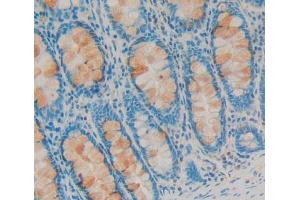 Used in DAB staining on fromalin fixed paraffin- embedded Kidney tissue (SDCBP anticorps  (AA 2-298))
