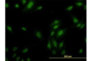 Image no. 3 for anti-Ribosomal Protein L9 (RPL9) (AA 93-192) antibody (ABIN598584) (RPL9 anticorps  (AA 93-192))