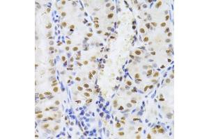 Immunohistochemistry of paraffin-embedded human stomach using XRCC5 Antibody (ABIN5973473) at dilution of 1/100 (40x lens). (XRCC5 anticorps)