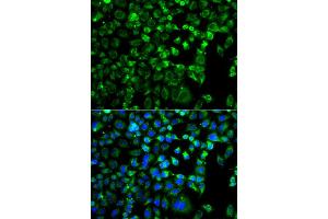 Immunofluorescence analysis of A549 cell using ZAK antibody.