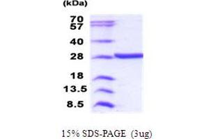 SDS-PAGE (SDS) image for Methyltransferase Like 21D (METTL21D) (AA 1-229) protein (His tag) (ABIN5853997)