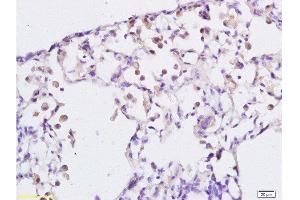 Formalin-fixed and paraffin embedded rat lung labeled with Anti-LTB4-R1/BLTR Polyclonal Antibody, Unconjugated  at 1:200 followed by conjugation to the secondary antibody and DAB staining.