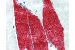 Anti-TNNI / Troponin I Skeletal antibody IHC of human skeletal muscle.
