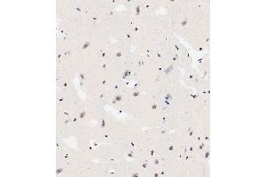 Immunohistochemical analysis of paraffin-embedded human brain tissue using (ABIN6242564 and ABIN6578912) performed on the Leica® BOND RXm.