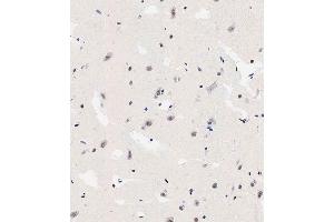 Immunohistochemical analysis of paraffin-embedded human brain tissue using (ABIN6242564 and ABIN6578912) performed on the Leica® BOND RXm. (TNIK anticorps  (Ser764))