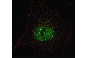 Fluorescent confocal image of SY5Y cells stained with phospho-PDX1 antibody. (PDX1 anticorps  (pThr11))