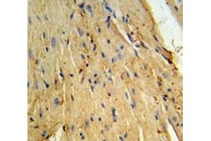 Phospholamban antibody IHC analysis in formalin fixed and paraffin embedded mouse heart tissue.