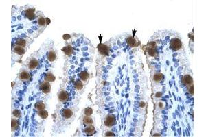 Image no. 1 for anti-Zinc Finger Protein 70 (ZNF70) (AA 119-168) antibody (ABIN202542)